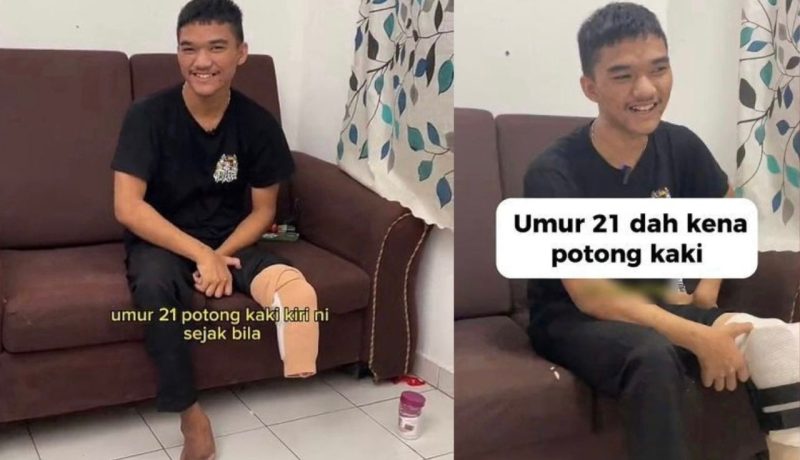“Balik sekolah je mesti beli” – Pemuda 21 tahun kongsi punca kaki dipotong akibat kencing manis